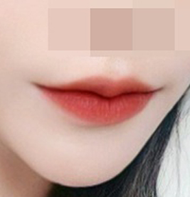 Lips chu~ ♥ So pretty now?