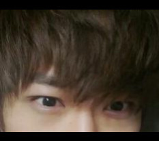 Men's incisional double-eyelid review