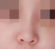 My Nose Looks Pretty, Right?!