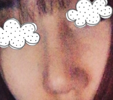 Got my nose done and totally transformed my look '-'♥