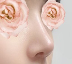 How my nose revision with autologous rib cartilage succeeded