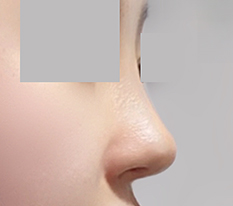 Straight-slope nose! It came out well haha