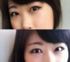 So this is why people get plastic surgery — the effect is amazing >ㅁ<