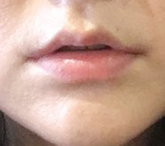 From timid-looking lips to sexy!