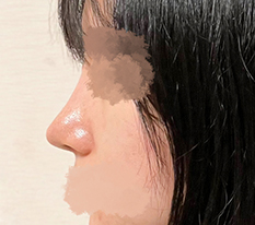A slim nose completed
