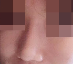 My nose that was just big has become so soft ㅎ