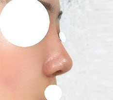 A graceful nose!!!