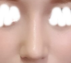For noses, Hyundai Aesthetic Surgery!!