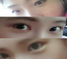 I'm totally satisfied with my eyes haha
