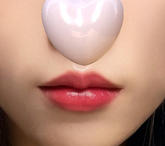Lip surgery without scars