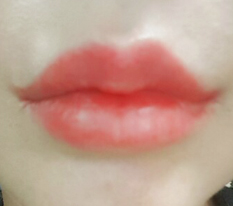 Mouth corners lol