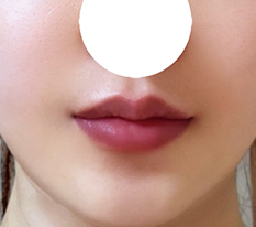 Pretty lips for life!