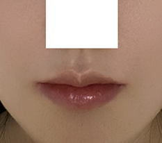 Clean lips~