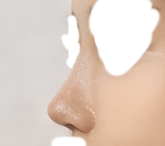 A really pretty nose haha