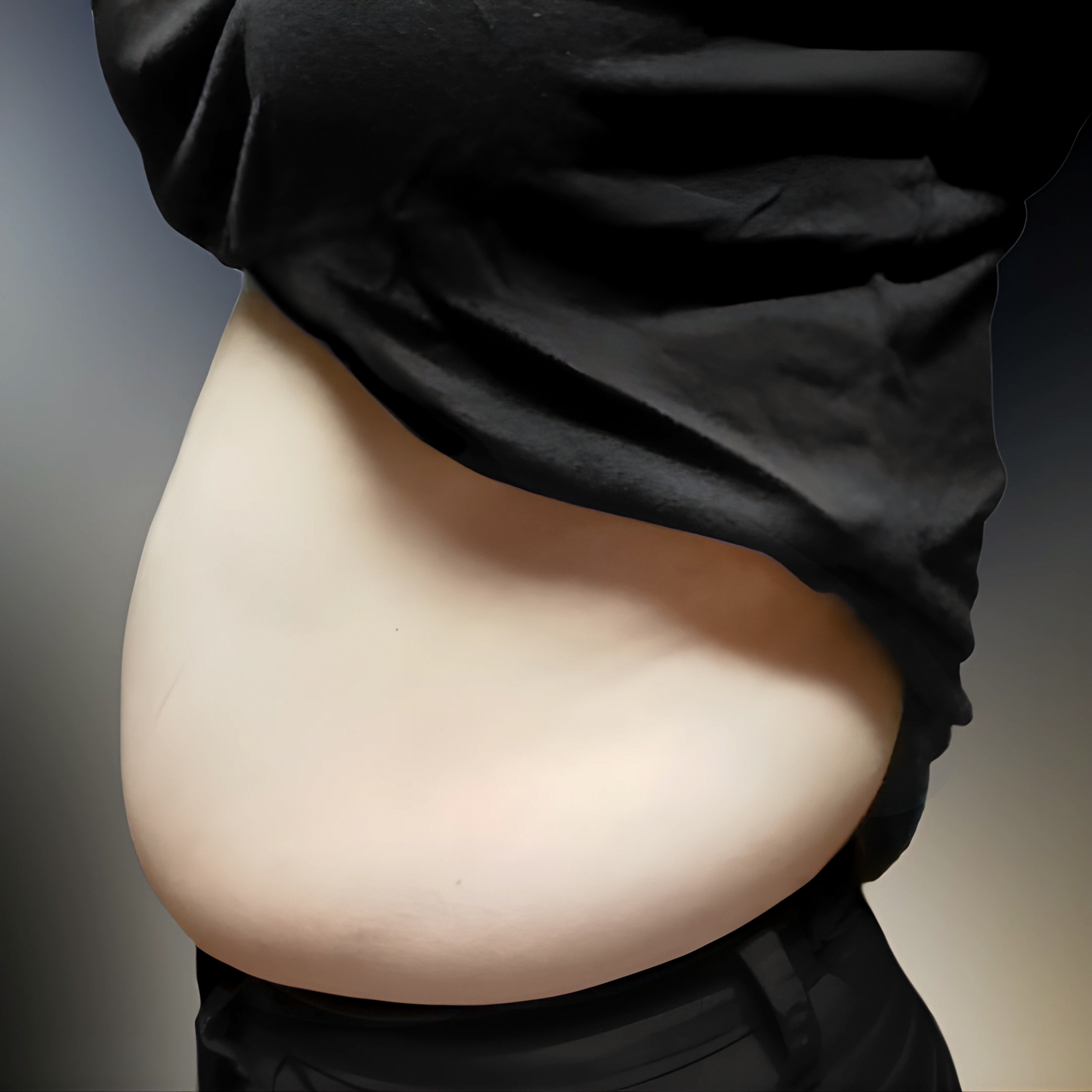 I cut off my belly fat #lovehandles #flanks #backflanks #abdomen
