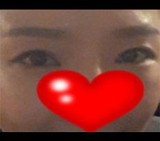 Eye surgery review^*^