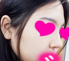 From a pumpkin-like nose to a cucumber-like nose lol