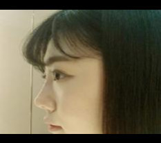 Nose filler was amazing