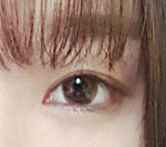 My personal review after double eyelid surgery and eye-opening procedures haha