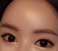 Hyundai Aesthetic Surgery is the best!