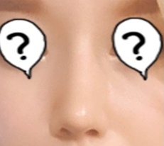 My unattractive nose changed my whole image after rhinoplasty at Hyundai Aesthetic Surgery!