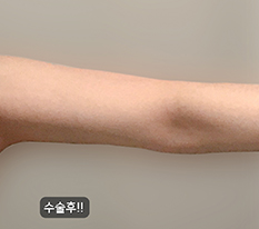 My arm stress is gone haha