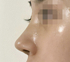 Don't you all think my nose turned out really great?ㅎ