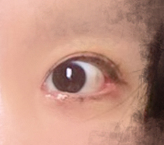 My eyes became more defined!!