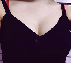The volume of my once flat chest is amazing...!! It also looks incredibly natural^^