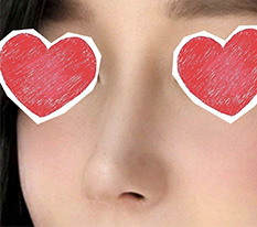 Coming to leave my 3-month rhinoplasty review! ㅎㅎ