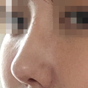 The doctor shaped the line so nicely ㅎ