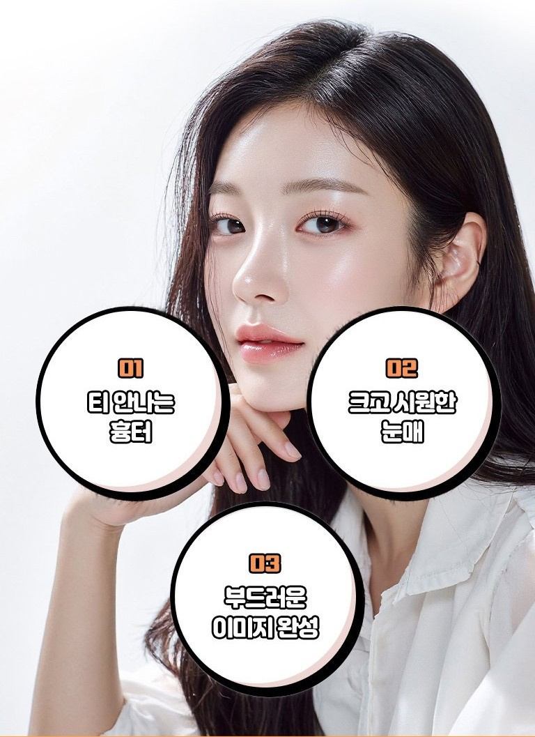 Epicanthoplasty result model — larger, more open-looking eyes