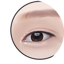 Epicanthoplasty step 1 — designing the appropriate line