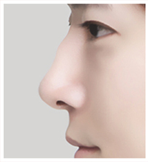 Hump nose side-profile case 1