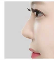 Hump nose side-profile case 2