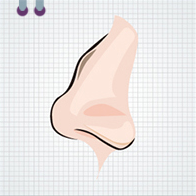 Before severe hump nose correction