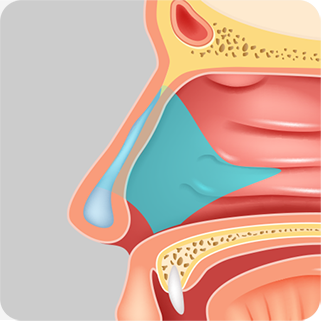 Illustration of the septal cartilage location