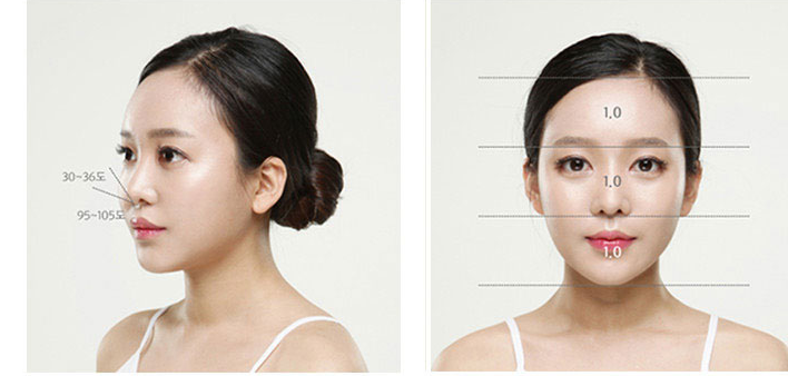 Side and front facial photos showing the criteria for an ideal nose shape (angle and proportion markings)