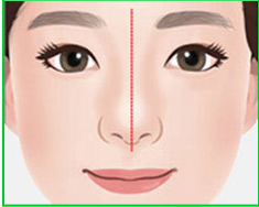 Illustration of a normal nose shape