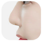 Illustration of a nose with a high nasal bridge